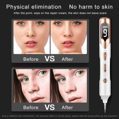 Electric Plasma Mole Removal Pen Laser Set Wart Remover Skin Pore Care Corn Freckle Dark Tag Nevus Pimple Spot Tattoo Cleaner - Image 4
