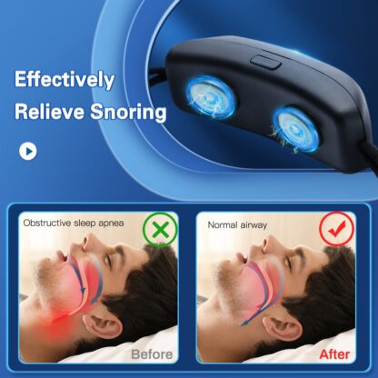 Smart Anti Snoring Device EMS Pulse Stop Snore Portable Comfortable Sleep Well Stop Snore Health Care Sleep Apnea Aid USB - Image 4